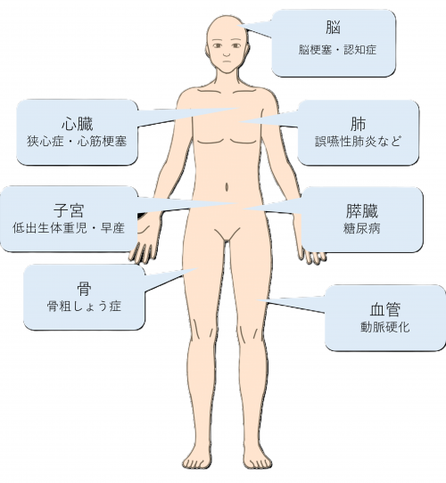 歯周病が全身に及ぼす影響